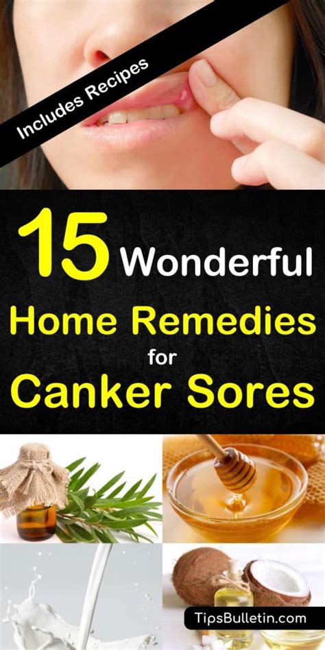 7 Ways to Get Rid of Canker Sores for Fast Relief .